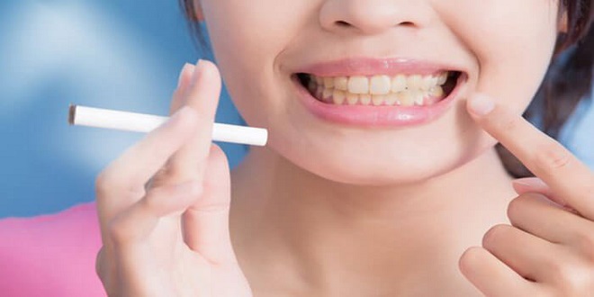 Smoking Safely after a Tooth Extraction: What You Need to Know